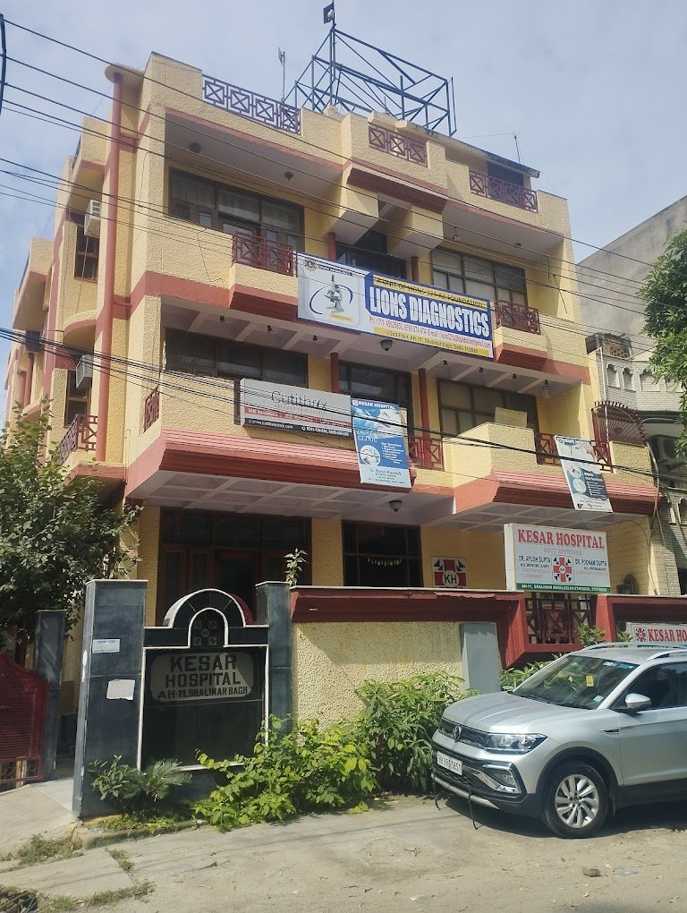 Blog Image